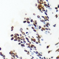 PNKP Rabbit Polyclonal Antibody