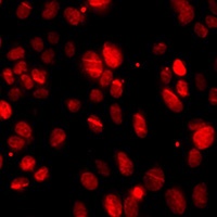 PNKP Rabbit Polyclonal Antibody