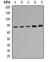 POR Rabbit Polyclonal Antibody