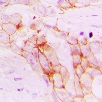 POR Rabbit Polyclonal Antibody