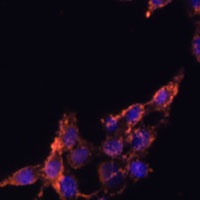 POR Rabbit Polyclonal Antibody