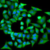 PPP2R1A Rabbit Polyclonal Antibody