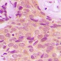 PPP2R4 Rabbit Polyclonal Antibody