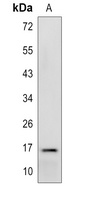 PPP3R2 Rabbit Polyclonal Antibody