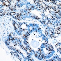 RBBP5 Rabbit Polyclonal Antibody