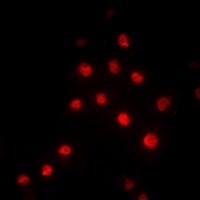 RBBP5 Rabbit Polyclonal Antibody