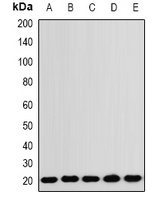 RNF5 Rabbit Polyclonal Antibody