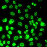 RPA3 Rabbit Polyclonal Antibody