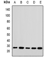 RPL14 Antibody