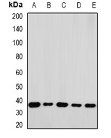 RPLP0 Rabbit Polyclonal Antibody