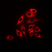 RPLP0 Rabbit Polyclonal Antibody