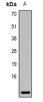 MRP8 Rabbit Polyclonal Antibody