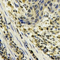 MRP8 Rabbit Polyclonal Antibody
