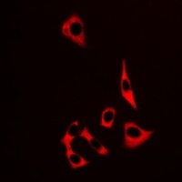 MRP8 Rabbit Polyclonal Antibody
