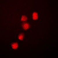 BRG1 Rabbit Polyclonal Antibody