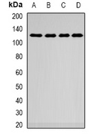 SMARCAD1 Rabbit Polyclonal Antibody