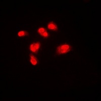 SPHK1 Rabbit Polyclonal Antibody