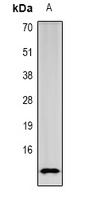 SPINK1 Rabbit Polyclonal Antibody