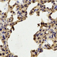 STIP1 Rabbit Polyclonal Antibody