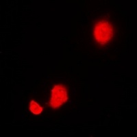 STIP1 Rabbit Polyclonal Antibody