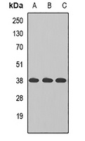 TAMM41 Rabbit Polyclonal Antibody