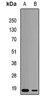 TNNC2 Rabbit Polyclonal Antibody