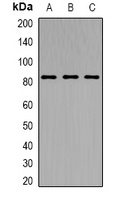 TRPV5 Rabbit Polyclonal Antibody