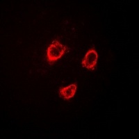 TRPV5 Rabbit Polyclonal Antibody