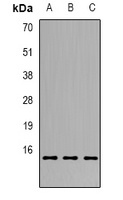 GILZ Rabbit Polyclonal Antibody