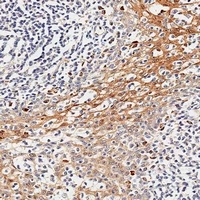 GILZ Rabbit Polyclonal Antibody