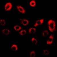 GILZ Rabbit Polyclonal Antibody