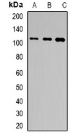 TSHR Rabbit Polyclonal Antibody