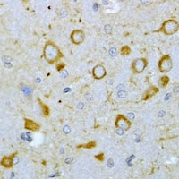 TSHR Rabbit Polyclonal Antibody