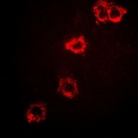 STS-1 Rabbit Polyclonal Antibody