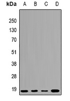 UBCH7 Rabbit Polyclonal Antibody