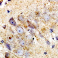 UBCH7 Rabbit Polyclonal Antibody