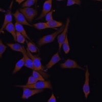 UBCH7 Rabbit Polyclonal Antibody