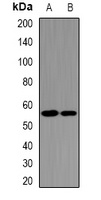 UGDH Rabbit Polyclonal Antibody