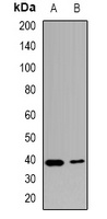 USF1 Rabbit Polyclonal Antibody