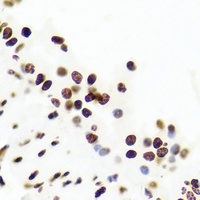 USF1 Rabbit Polyclonal Antibody