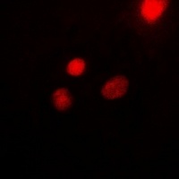 USF1 Rabbit Polyclonal Antibody