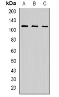 p115 Rabbit Polyclonal Antibody