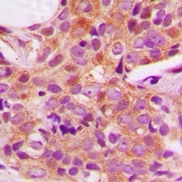 p115 Rabbit Polyclonal Antibody