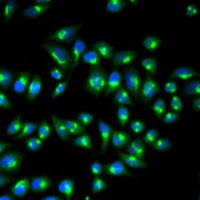 p115 Rabbit Polyclonal Antibody
