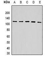 USP10 Rabbit Polyclonal Antibody