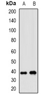 WNT7B Rabbit Polyclonal Antibody