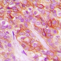 AT1 Rabbit Polyclonal Antibody
