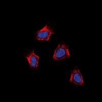 AT1 Rabbit Polyclonal Antibody
