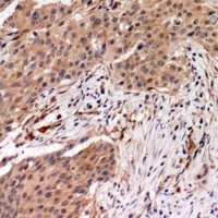 MYPT1 (Phospho-T696) Antibody