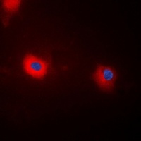 MYPT1 (Phospho-T696) Antibody